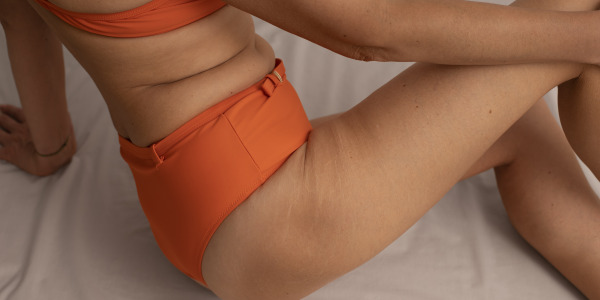 Co na czerwone rozstępy? Nasze sposoby