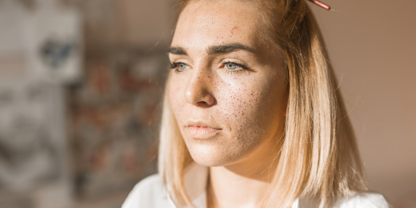 Wybroczyny na twarzy - skąd się biorą?
