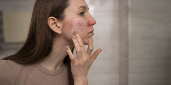 Kontrolowane uszkodzenie naskórka - na czym polega?