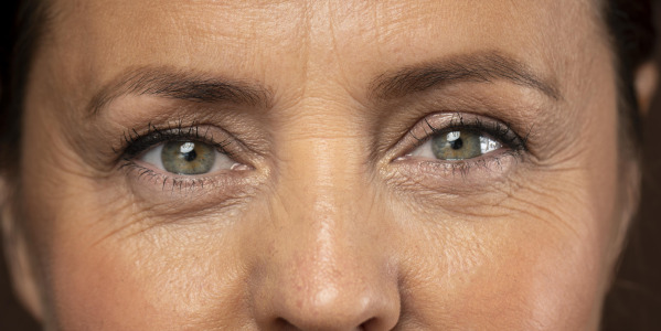 Zmarszczki kurze łapki – dlaczego powstają?