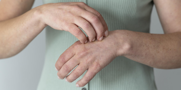 Przebarwienia na dłoniach – jak je zlikwidować?